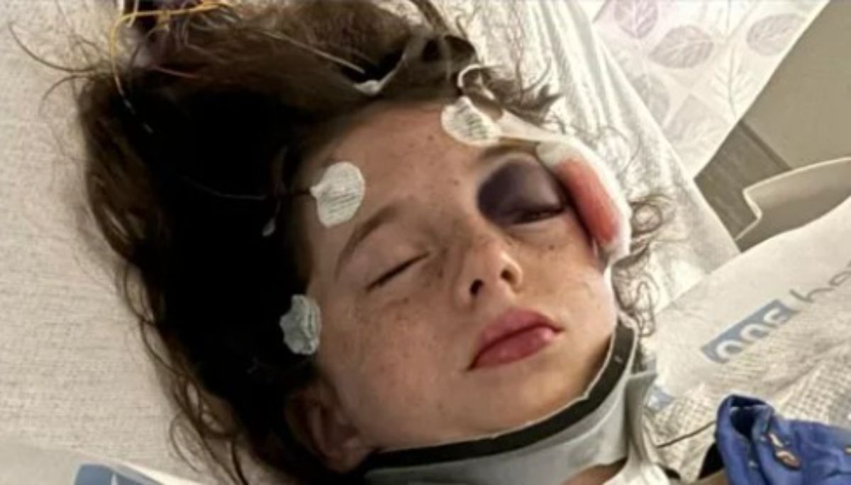 Ten-Year-Old Sophia Martinez Suffers Severe Head Injury from Baseball Bat Incident